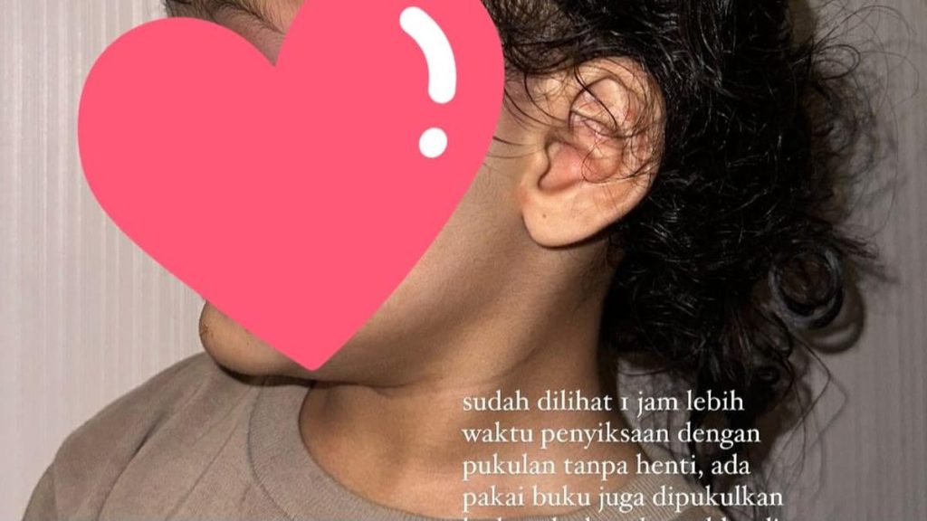 Penganiayaan Pengasuh ke Anak Selebgram Aghnia Terjadi Sekitar Jam 4-5 Pagi