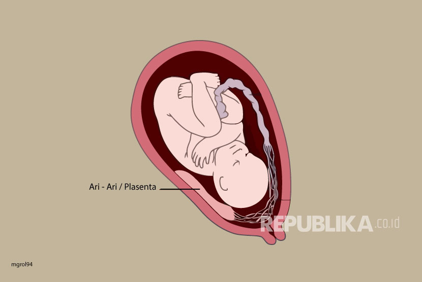 Tanda Janin Usia 20 Minggu ke Atas Meninggal dalam Kandungan, Ini Gejala dan Penyebabnya