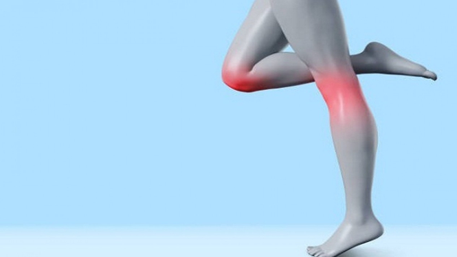 Mengenal Unicompartmental Knee Arthroplasty untuk Mengurangi Nyeri dan Perbaiki Fungsi Lutut